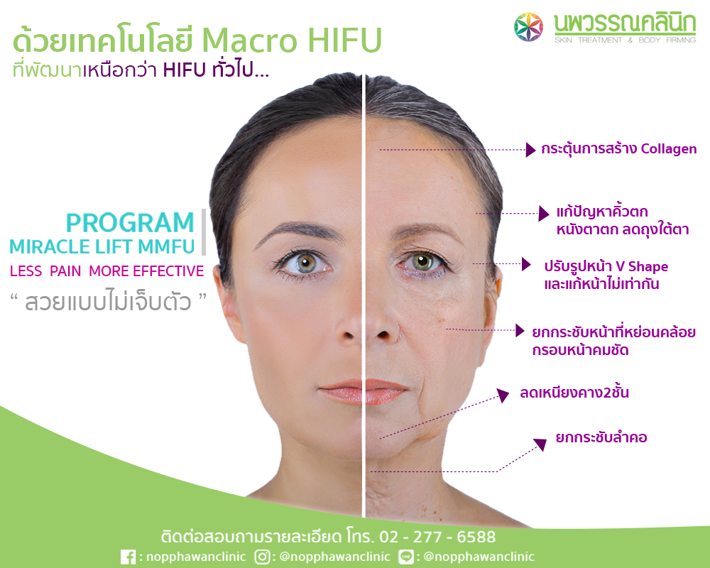 Nopphawanclinic-ad1.2-1