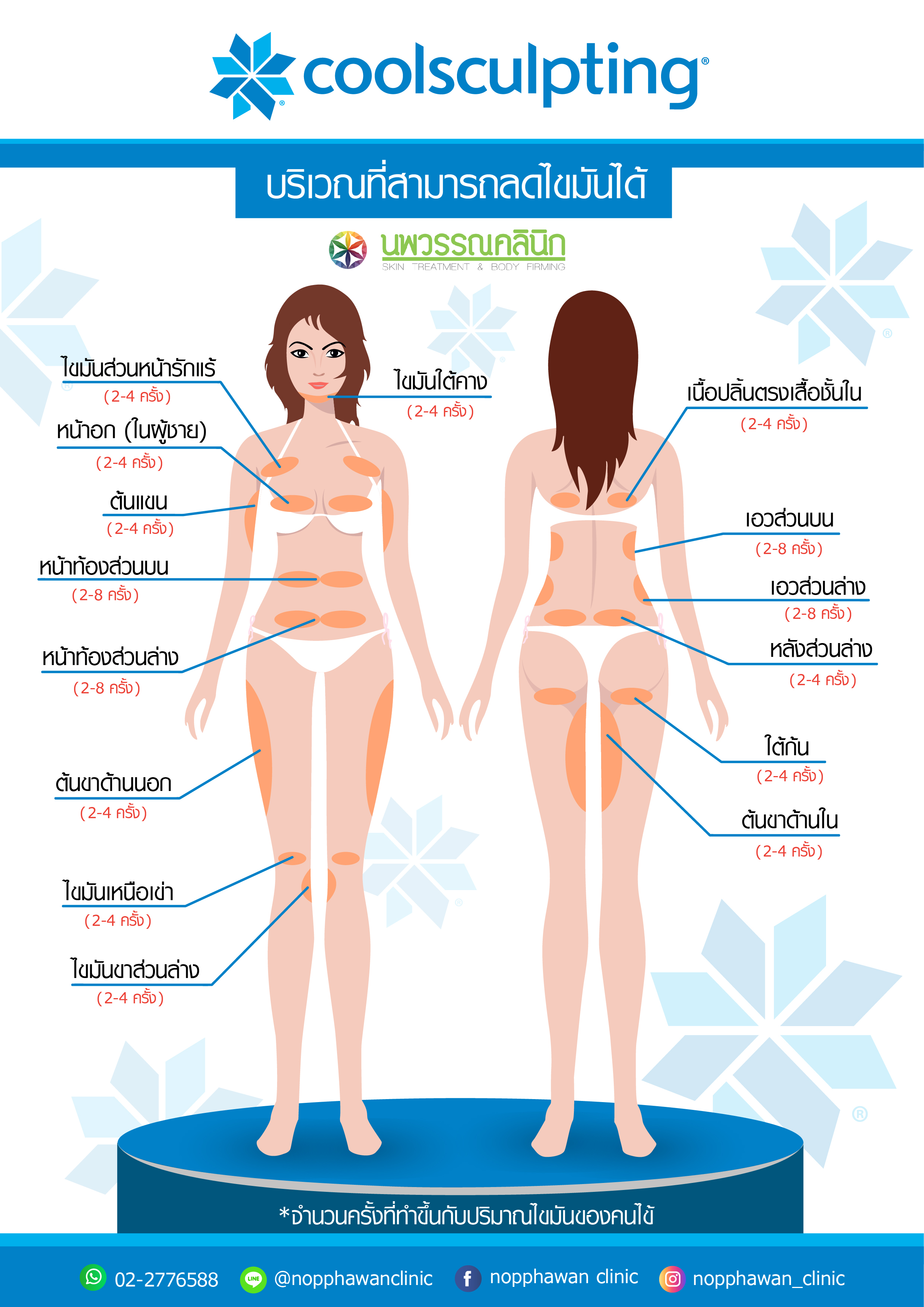 Coolsculpting6