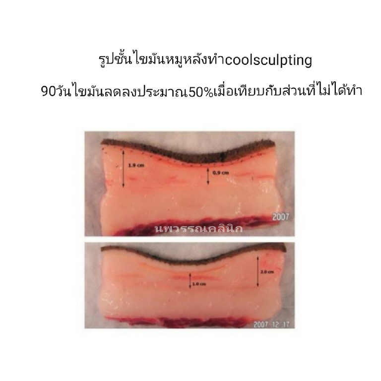 np1